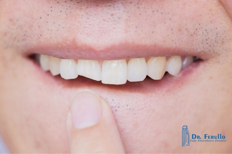 how-to-treat-a-chipped-tooth