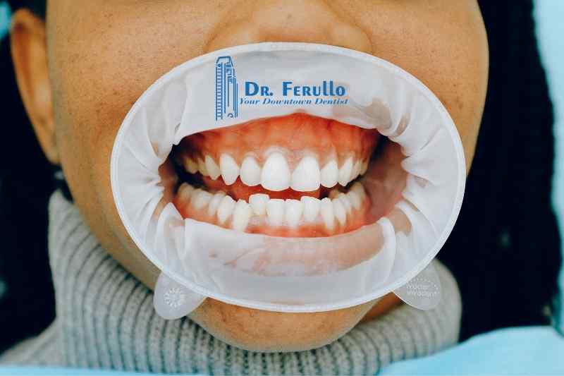 symptoms-of-periodontitis
