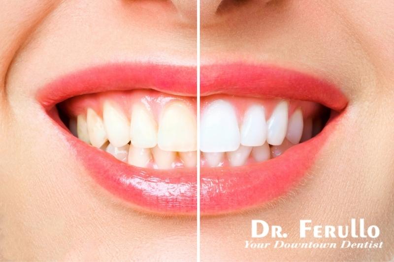 what-causes-teeth-yellowing