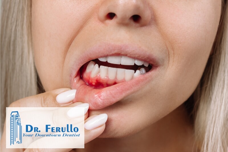 why-are-my-gums-bleeding
