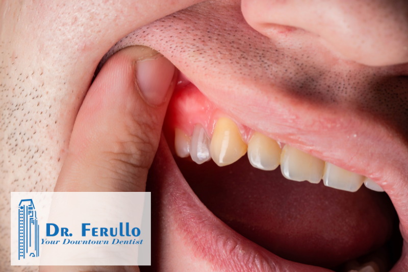 tooth-infection-symptoms