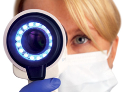 Diseases Your Dentist Can Detect - Oral Cancer screening with VELscope 